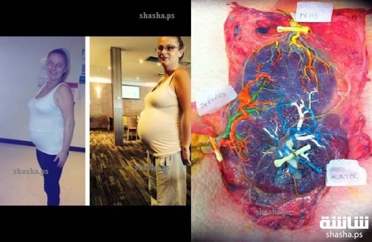 حدس الام لا يخطأ .. وهذه القصه خير دليل .. تابع 