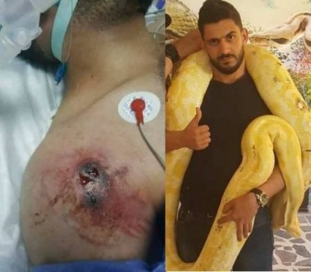 أفعى فلسطين' السّامة تلدغ خبير أفاعي أردني وتصيبه بجروحٍ خطيرة