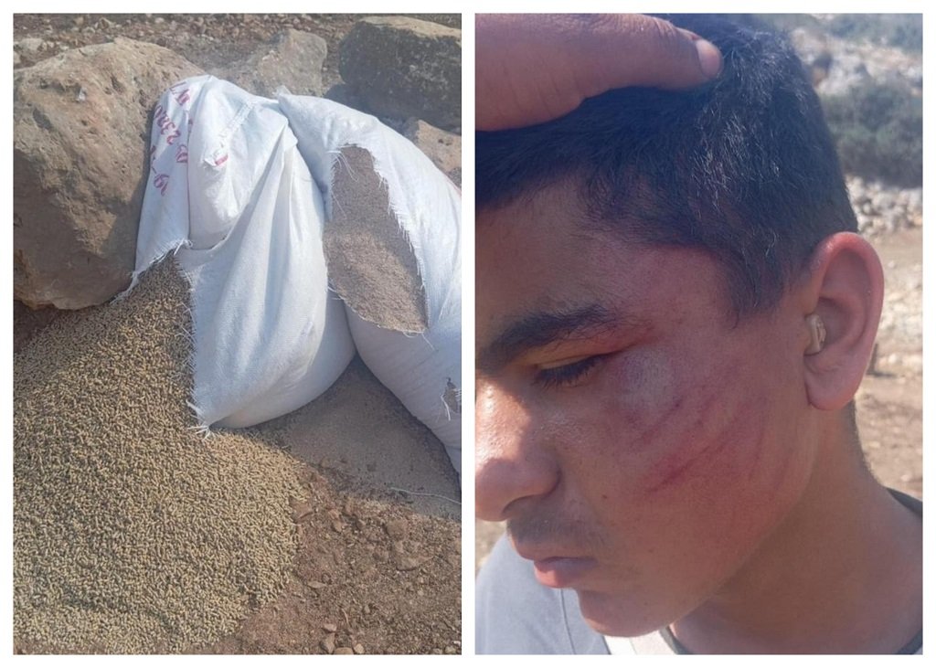 مستعمرون يعتدون بالضرب على طفل شمال غرب سلفيت 