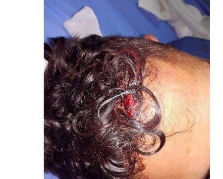 في الضفة.. 6 شبان يعتدون على طبيب