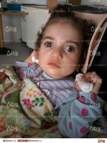 بعد أمير.. الطفلة ريتال من عملية تضييق شريان الى تلف كامل في الدماغ