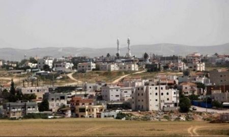 عاجل . اصابة طفلة بحروق خطيرة جراء انسكاب زيت ساخن عليها