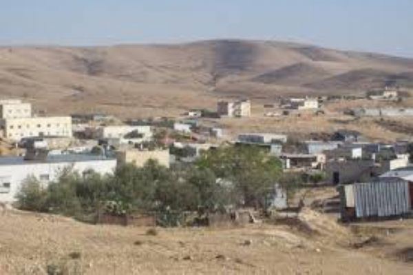 عاجل. اصابة خطيرة لطفل غرق في حوض للمياه