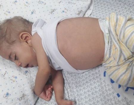 مواطن يناشد الرئيس عباس: طفلي في خطر