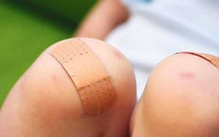 هل تخفف القبلة على مكان الكدمة او الإصابة من الألم؟