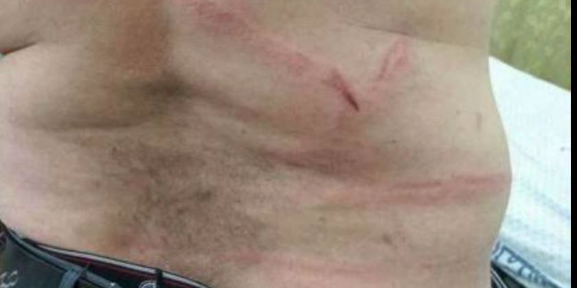 غزة: تفاصيل الاعتداء على مدرس بالضرب المبرح