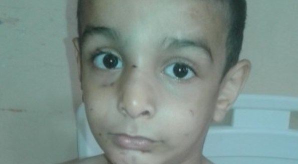 غزة: طفل يتعرض للضرب والحرق على يد جدته .. والتفاصيل مؤلمة
