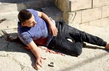 شهيد برصاصة اخترقت بطنه في مخيم العروب