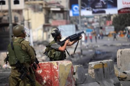 جنين: للمرة التاسعة .. إصابة شاب بالرصاص في نفس المكان