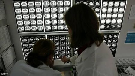 معظم المصابين بالسرطان سيهزمون المرض