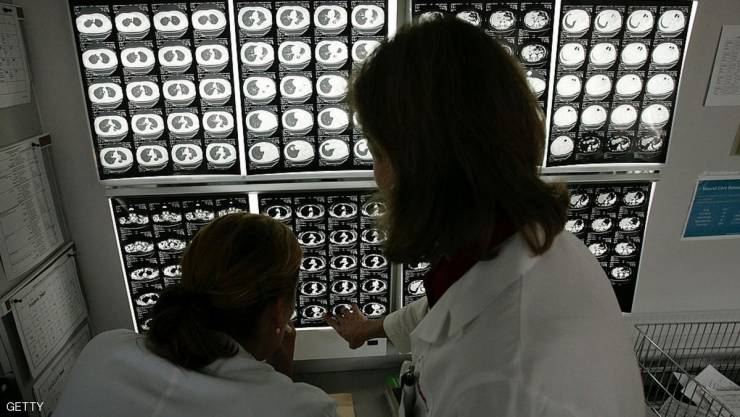 معظم المصابين بالسرطان سيهزمون المرض