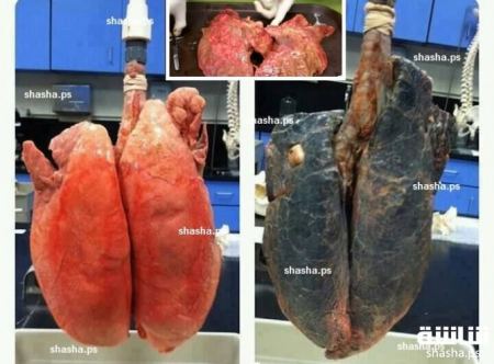 أفضل مشروب طبيعي يطهّر الرئتين من آثار التدخين