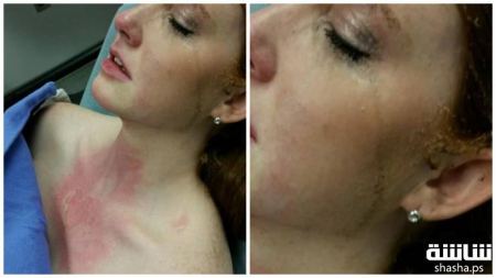 تحذير: اياكم وحمل اطفالكم بالمطبخ ... تابع لمعرفة السبب 