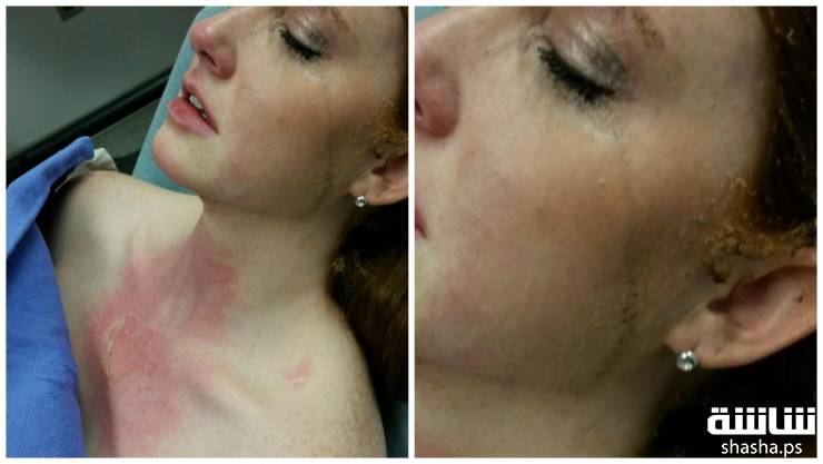 تحذير: اياكم وحمل اطفالكم بالمطبخ ... تابع لمعرفة السبب 