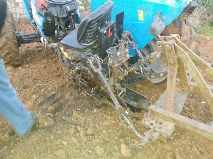 اصابة مواطن في انفجار جسم من مخلفات الاحتلال