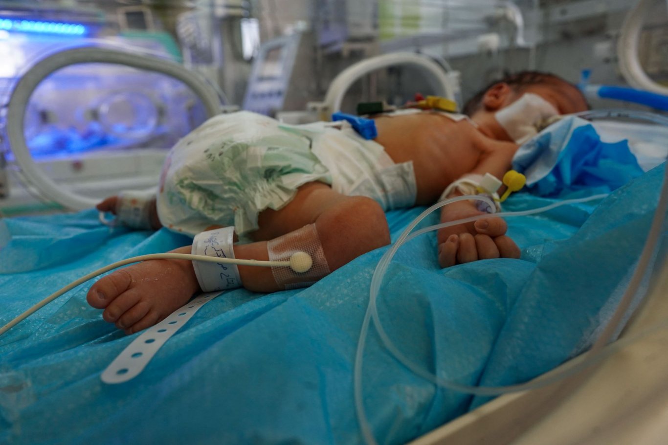 وفاة رضيعين جوعا جراء الحصار الإسرائيلي لغزة